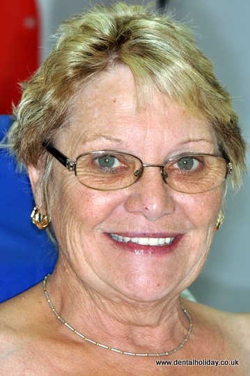 Christine with her new smile